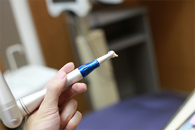 炭酸ガスレーザー